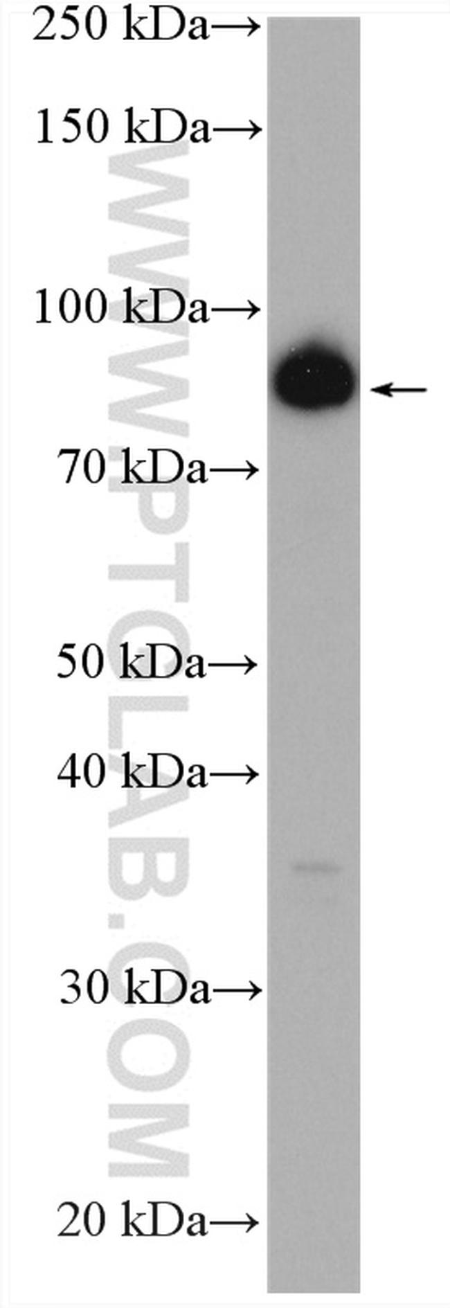 ZNF746 Antibody in Western Blot (WB)