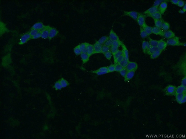 ZBTB8A Antibody in Immunocytochemistry (ICC/IF)