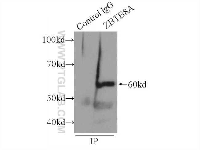 ZBTB8A Antibody in Immunoprecipitation (IP)