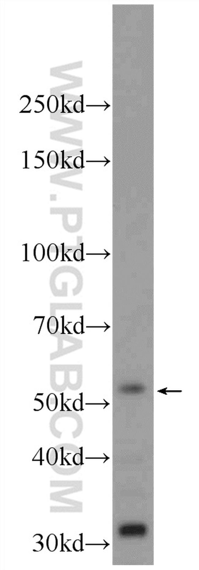 ZBTB8A Antibody in Western Blot (WB)