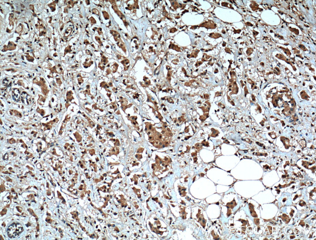 SHP1 Antibody in Immunohistochemistry (Paraffin) (IHC (P))