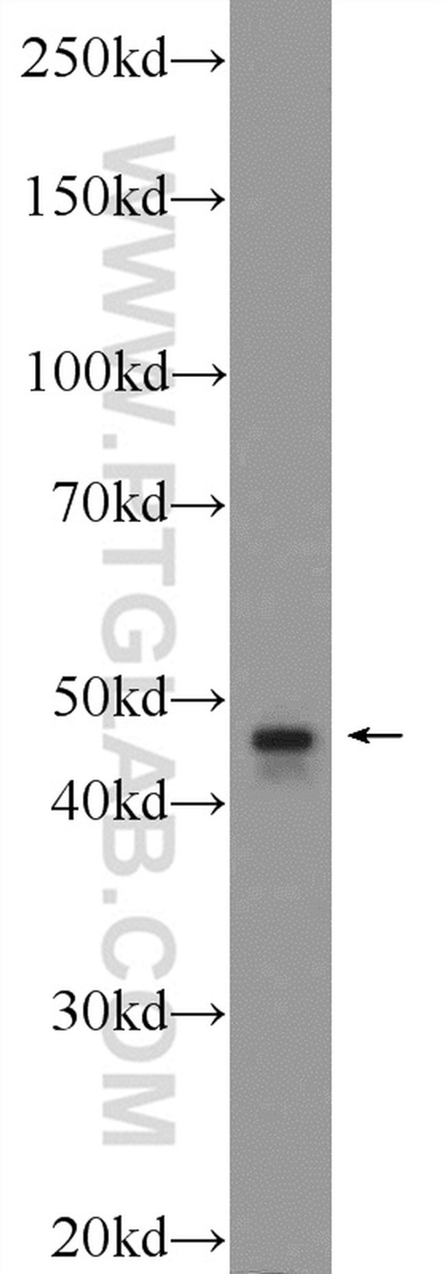 TBCEL Antibody in Western Blot (WB)