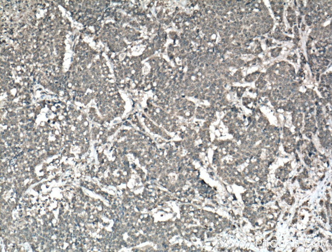 AMOT Antibody in Immunohistochemistry (Paraffin) (IHC (P))