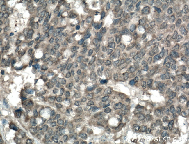 AMOT Antibody in Immunohistochemistry (Paraffin) (IHC (P))