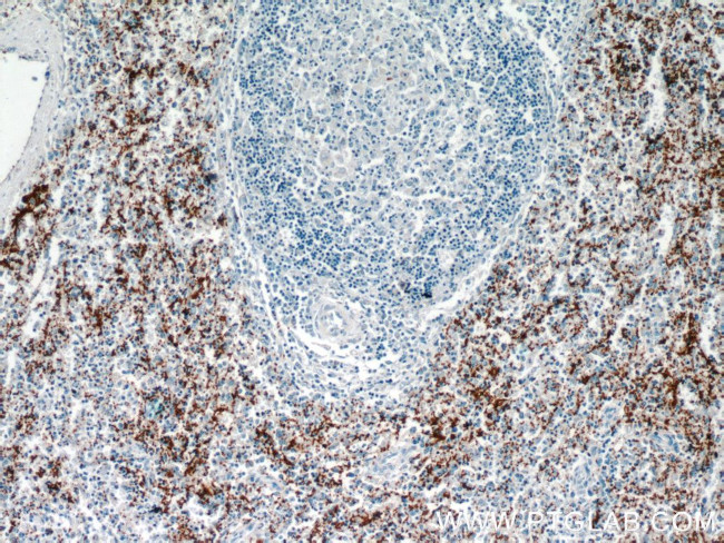 CD41/Integrin alpha 2b Antibody in Immunohistochemistry (Paraffin) (IHC (P))