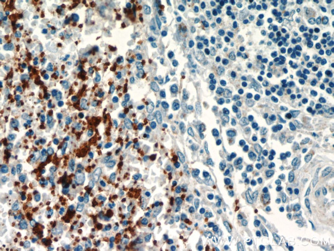 CD41/Integrin alpha 2b Antibody in Immunohistochemistry (Paraffin) (IHC (P))