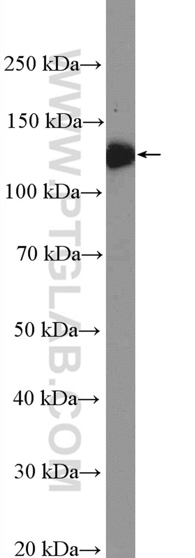 CD41/Integrin alpha 2b Antibody in Western Blot (WB)