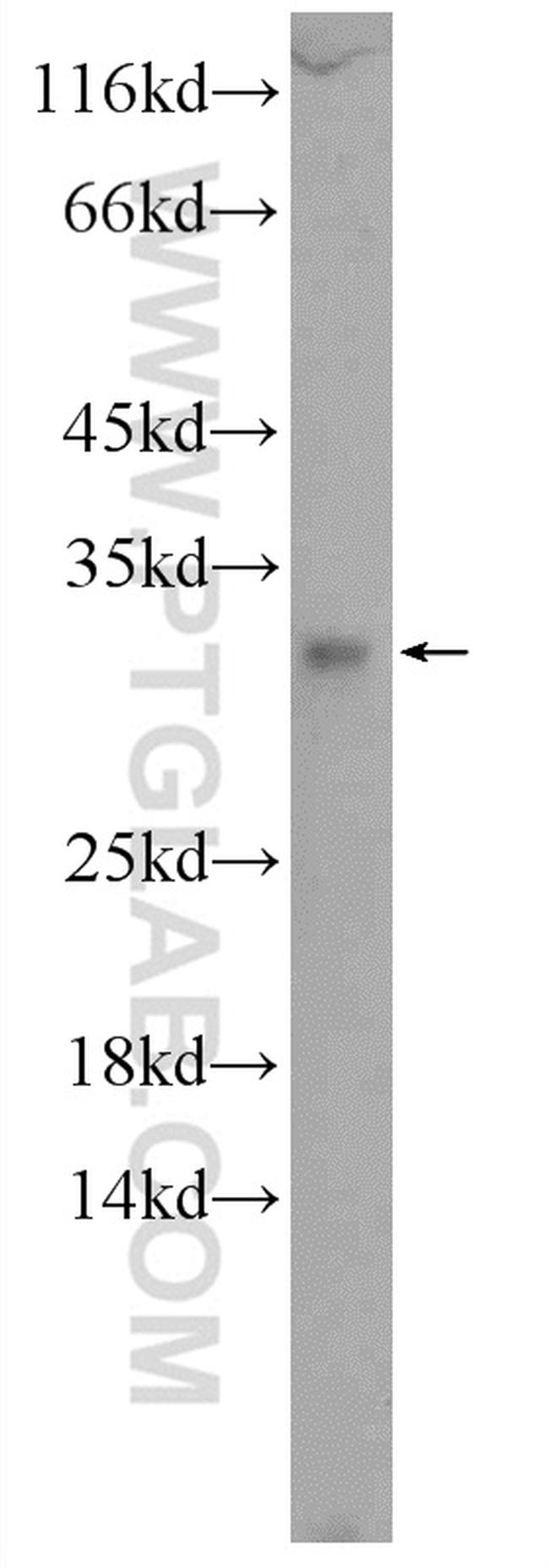 C15orf53 Antibody in Western Blot (WB)