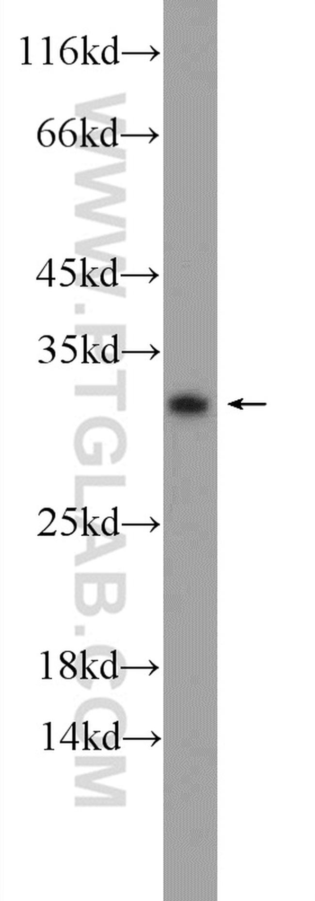 C15orf53 Antibody in Western Blot (WB)