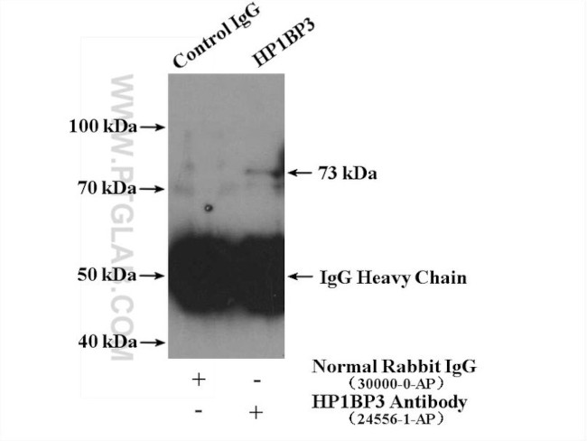 HP1BP3 Antibody in Immunoprecipitation (IP)