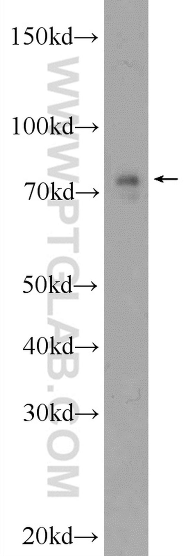 HP1BP3 Antibody in Western Blot (WB)