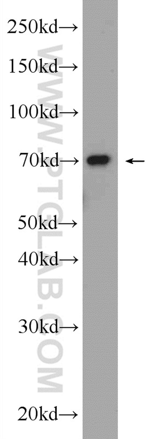 HP1BP3 Antibody in Western Blot (WB)