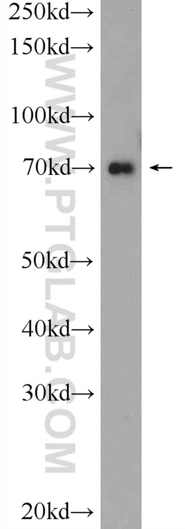 HP1BP3 Antibody in Western Blot (WB)