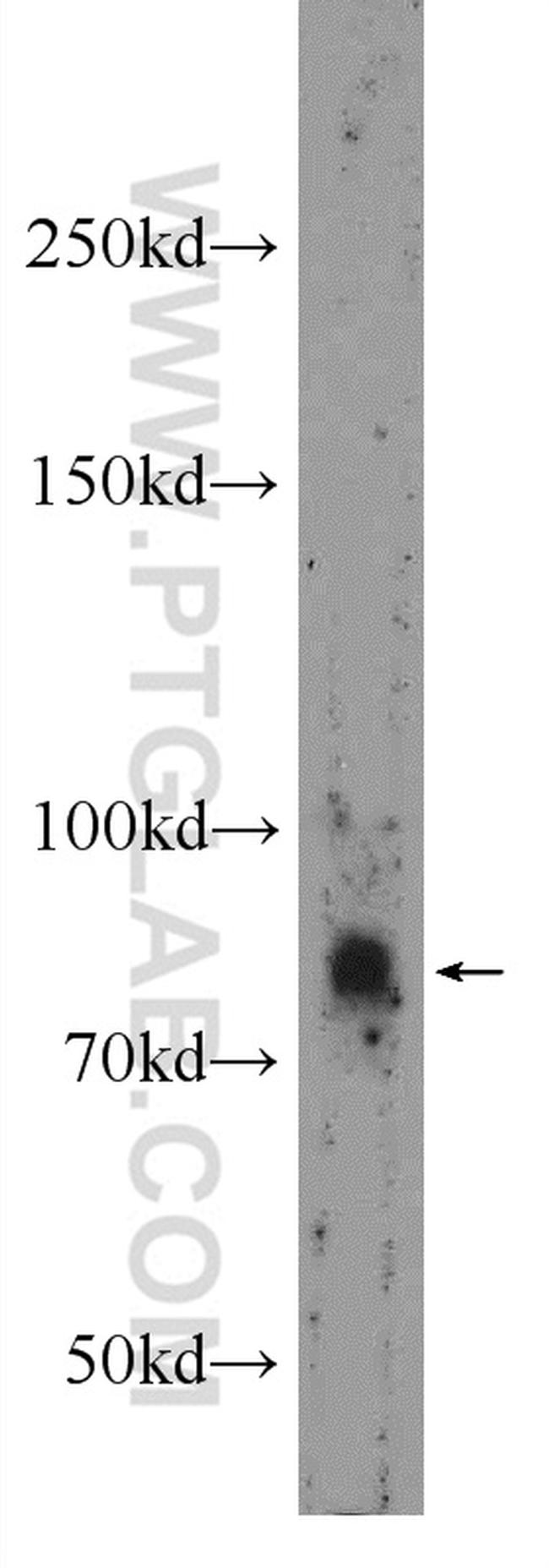 USP35 Antibody in Western Blot (WB)