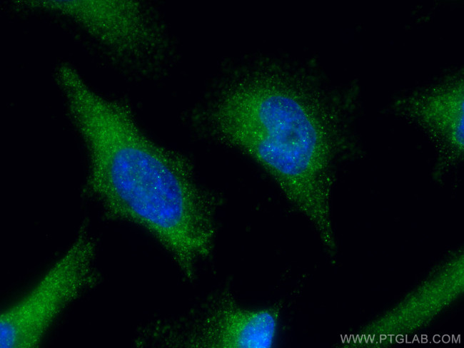 ZW10 Antibody in Immunocytochemistry (ICC/IF)