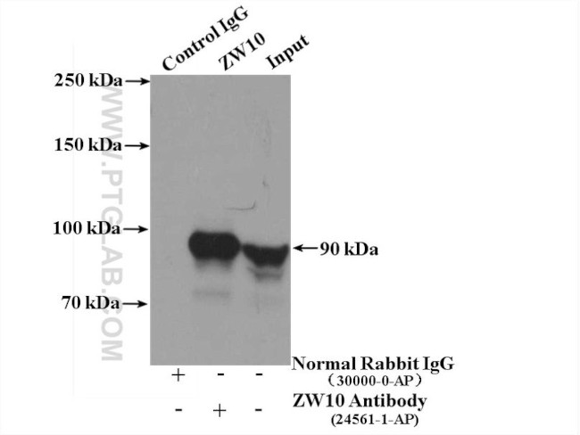 ZW10 Antibody in Immunoprecipitation (IP)