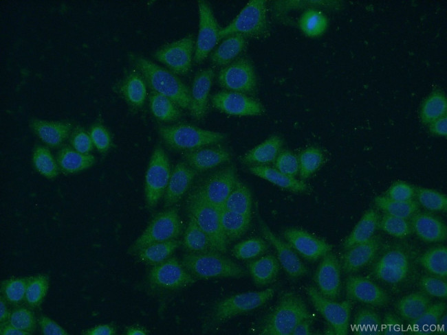 NCAPG Antibody in Immunocytochemistry (ICC/IF)