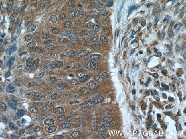 NCAPG Antibody in Immunohistochemistry (Paraffin) (IHC (P))