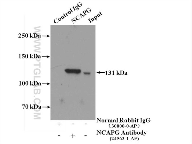 NCAPG Antibody in Immunoprecipitation (IP)