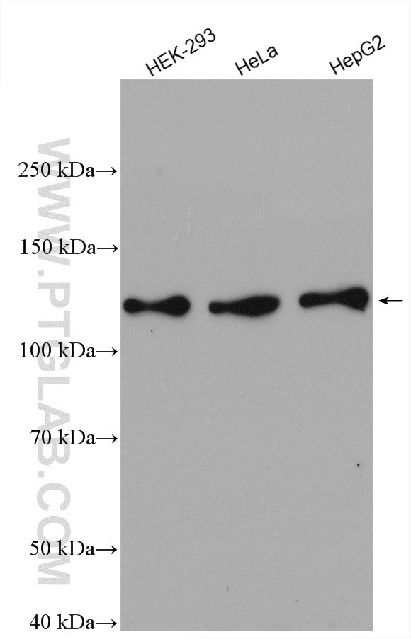 NCAPG Antibody in Western Blot (WB)