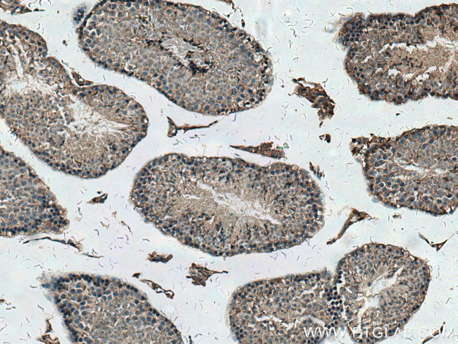 PCOTH Antibody in Immunohistochemistry (Paraffin) (IHC (P))