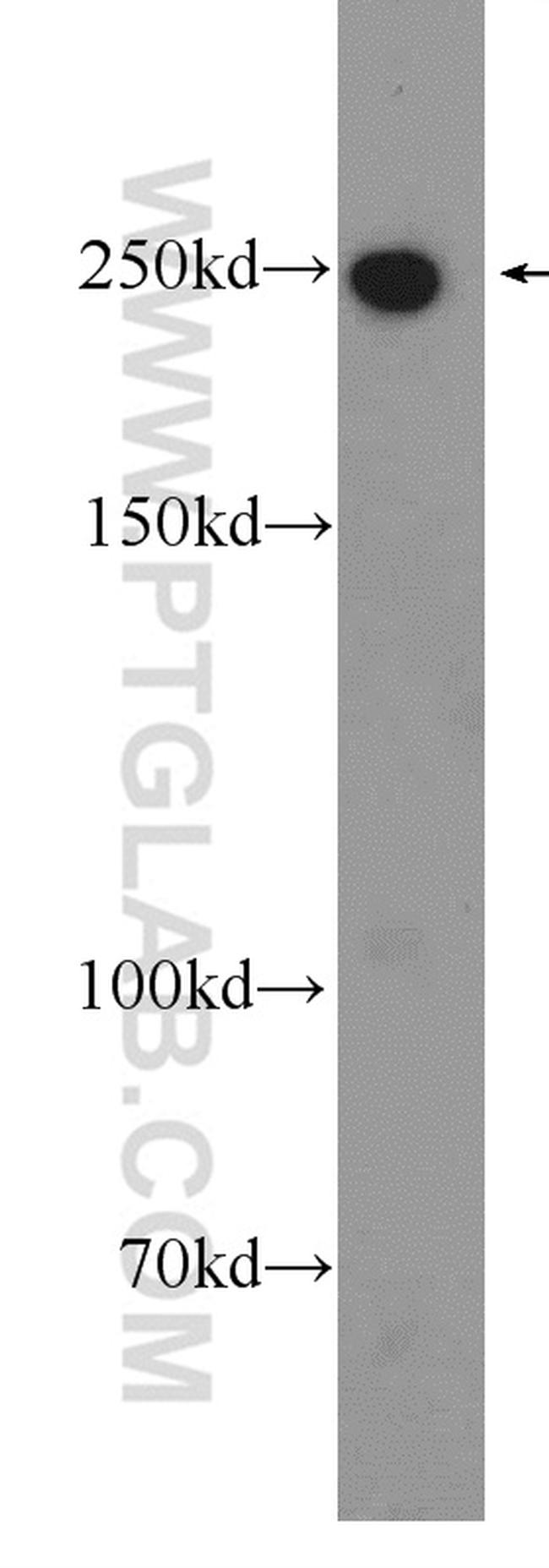 MYO10 Antibody in Western Blot (WB)