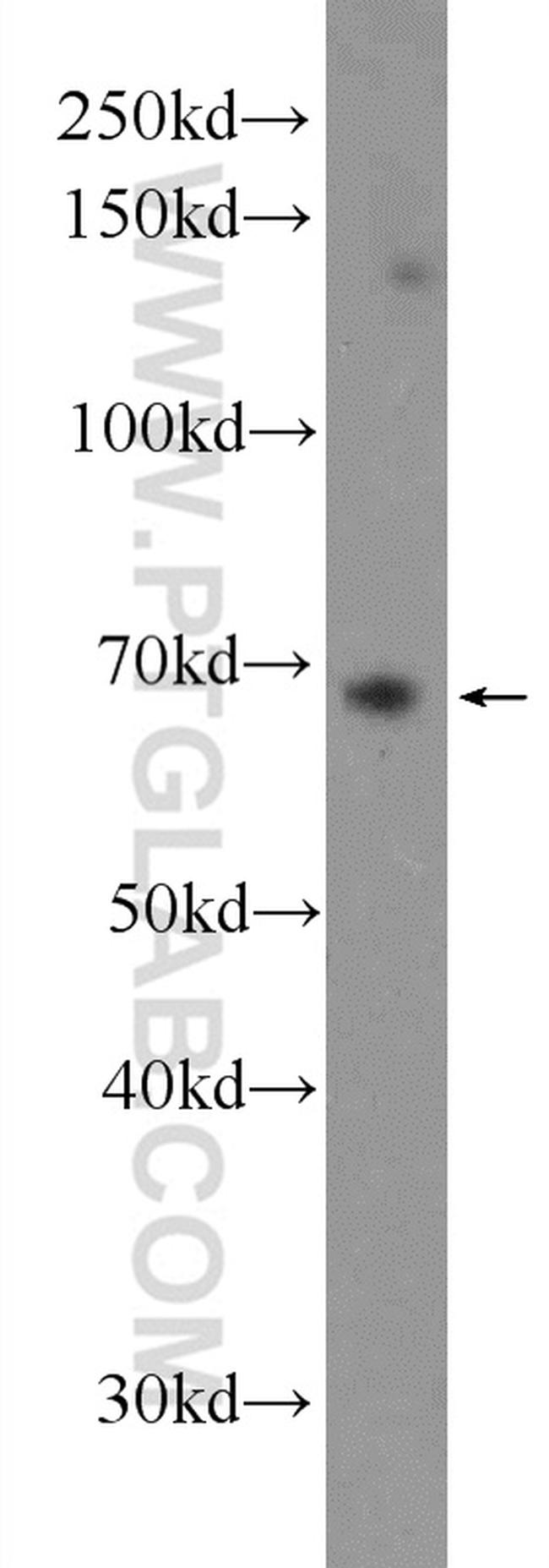 PTPN11 Antibody in Western Blot (WB)