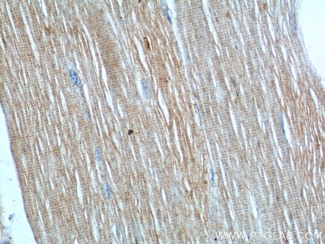 PTPN11 Antibody in Immunohistochemistry (Paraffin) (IHC (P))