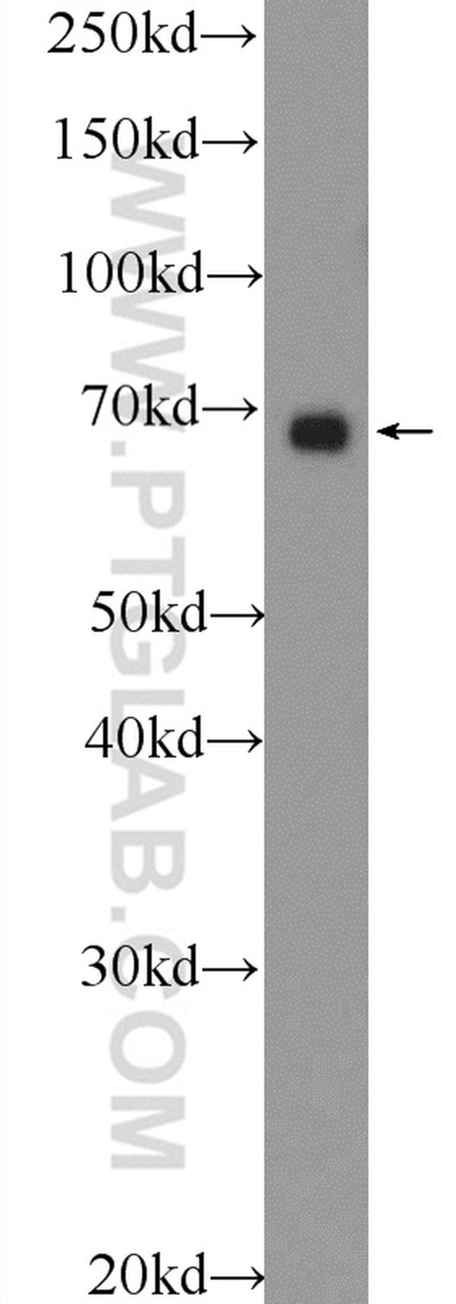 PTPN11 Antibody in Western Blot (WB)