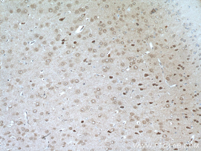 RIM1 Antibody in Immunohistochemistry (Paraffin) (IHC (P))