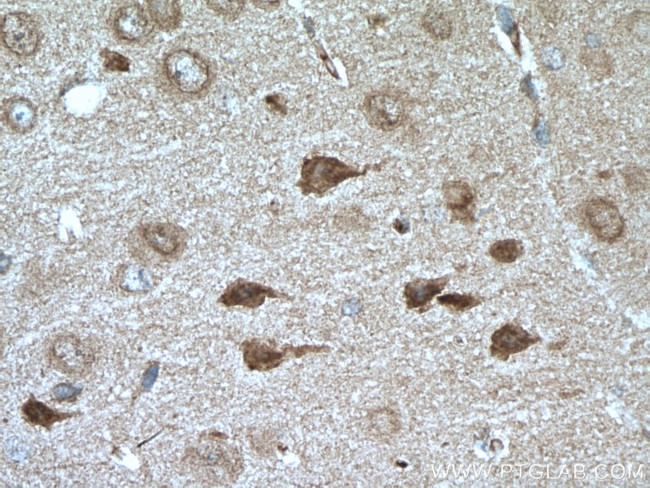 RIM1 Antibody in Immunohistochemistry (Paraffin) (IHC (P))