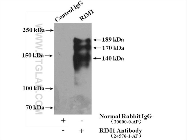 RIM1 Antibody in Immunoprecipitation (IP)