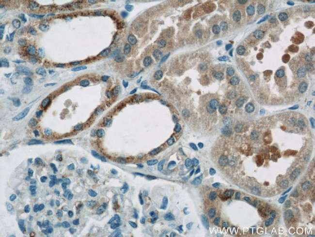 HEATR2 Antibody in Immunohistochemistry (Paraffin) (IHC (P))