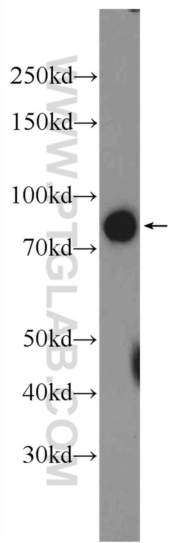 SLCO4C1 Antibody in Western Blot (WB)