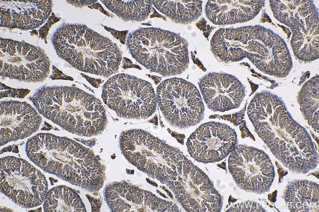 TEX15 Antibody in Immunohistochemistry (Paraffin) (IHC (P))