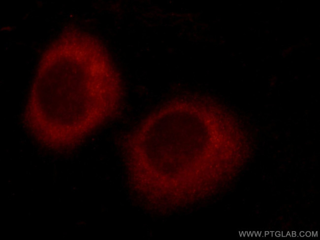 TTC37 Antibody in Immunocytochemistry (ICC/IF)