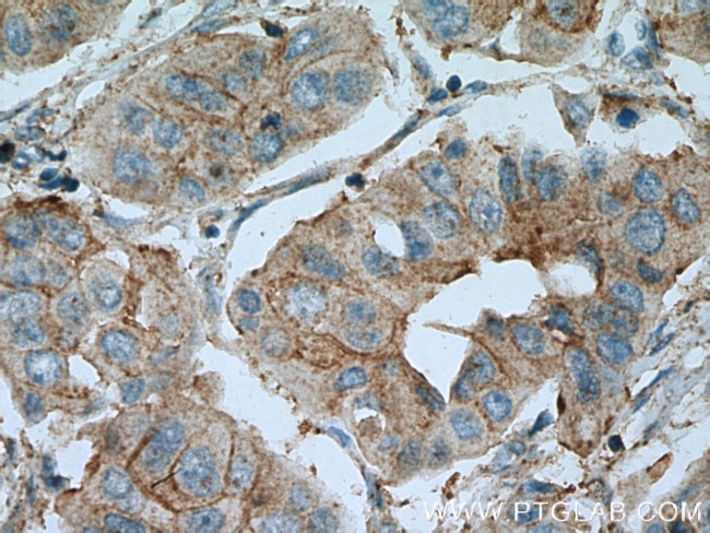 PAGE3 Antibody in Immunohistochemistry (Paraffin) (IHC (P))