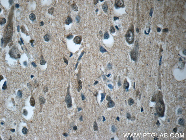 RAB3GAP2 Antibody in Immunohistochemistry (Paraffin) (IHC (P))