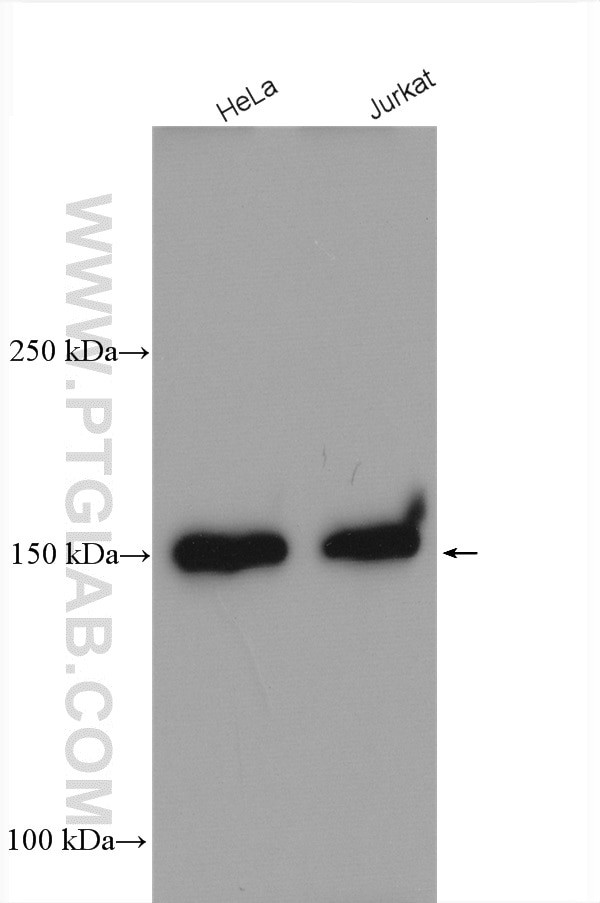 RAB3GAP2 Antibody in Western Blot (WB)