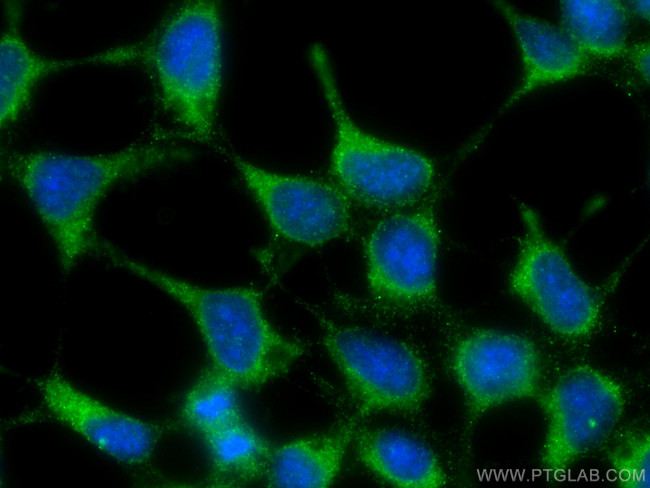 Tuberin Antibody in Immunocytochemistry (ICC/IF)