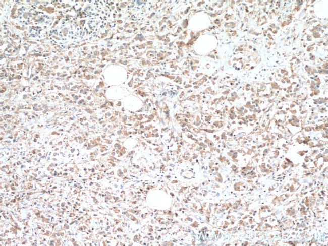 Tuberin Antibody in Immunohistochemistry (Paraffin) (IHC (P))