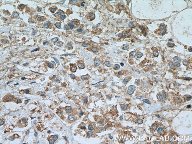 Tuberin Antibody in Immunohistochemistry (Paraffin) (IHC (P))