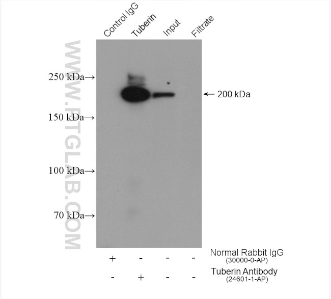 Tuberin Antibody in Immunoprecipitation (IP)