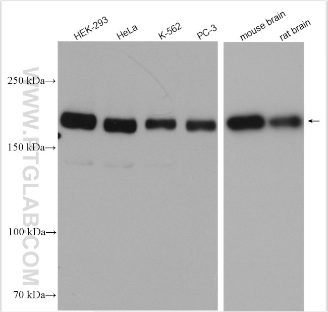 Tuberin Antibody in Western Blot (WB)