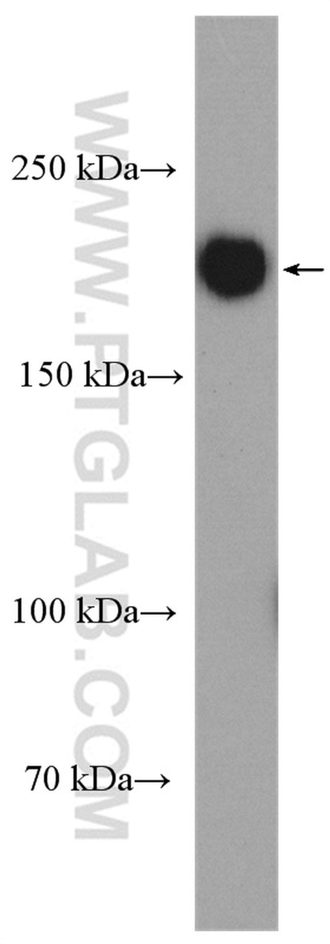 Tuberin Antibody in Western Blot (WB)