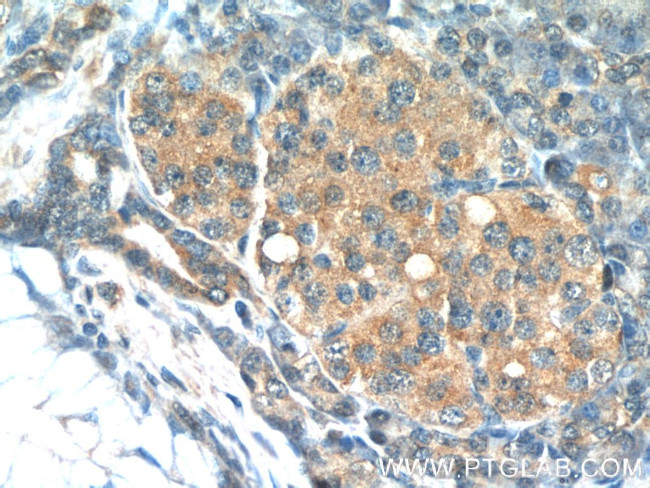 Tuberin Antibody in Immunohistochemistry (Paraffin) (IHC (P))