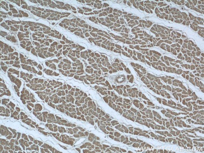 UPB1 Antibody in Immunohistochemistry (Paraffin) (IHC (P))