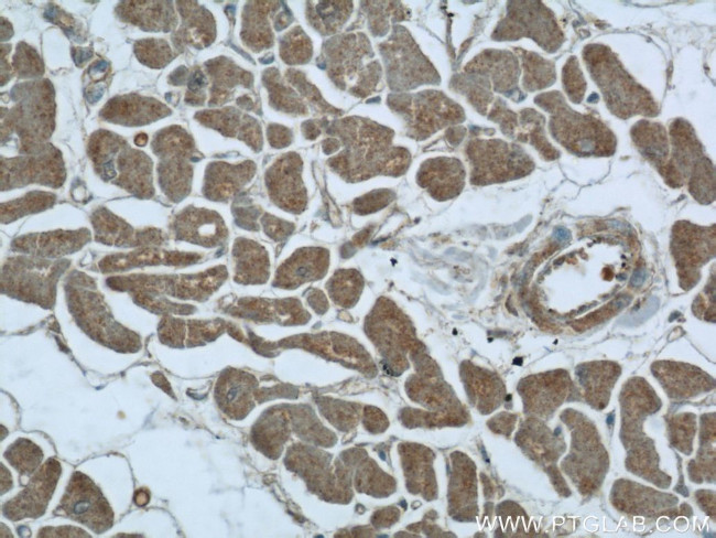 UPB1 Antibody in Immunohistochemistry (Paraffin) (IHC (P))