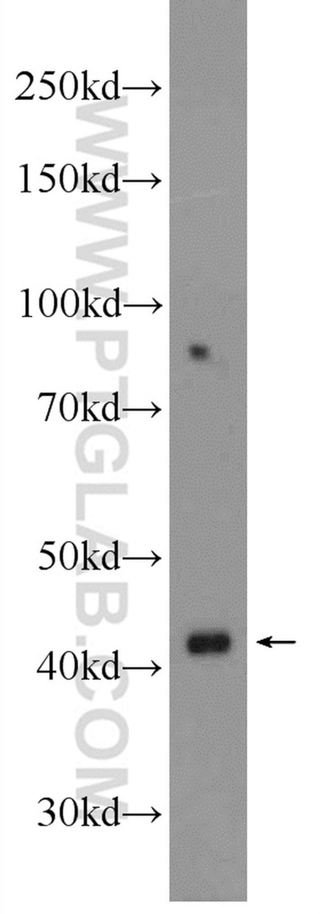 UPB1 Antibody in Western Blot (WB)