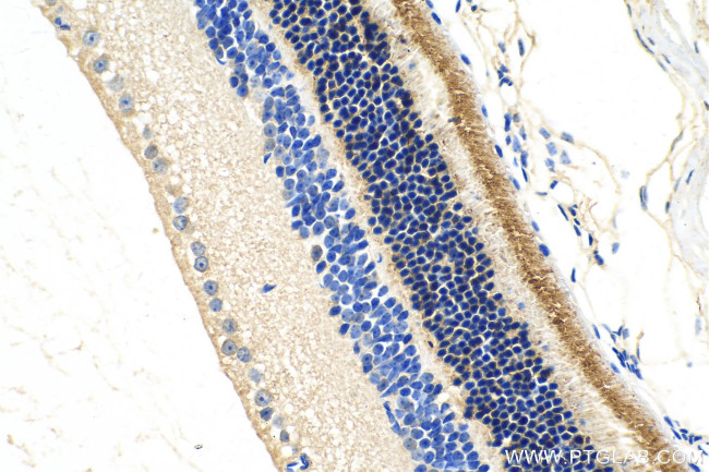 GRK1 Antibody in Immunohistochemistry (Paraffin) (IHC (P))